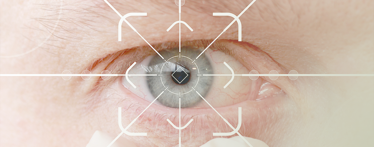 GLAUCOMA
